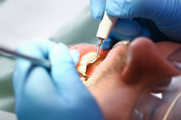 Best Emergency Treatment for Jaw Pain or Injury in South Barrington, IL